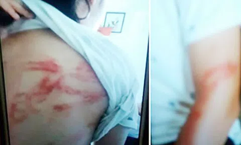 Vụ bạo hành con đẻ: Bố thường đấm, đá, tát, đập đầu con vào tường